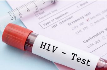 STRAŠNO: U Srbiji oboren rekord po broju HIV novozaraženih osoba!