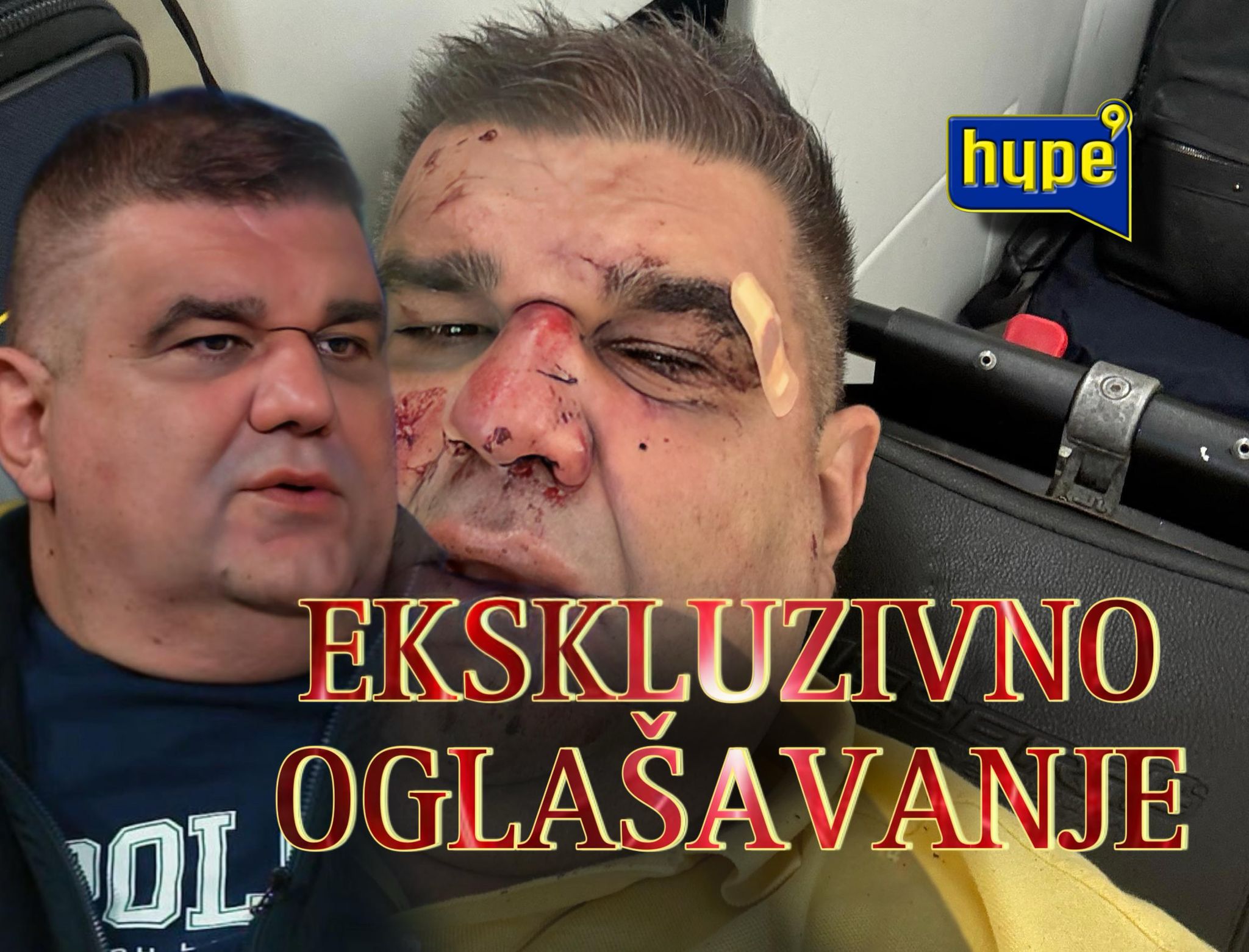 PRVO OGLAŠAVANJE SAŠE MIRKOVIĆA IZ BOLNICE! NAPADNUT KUKAVIČKI S LEĐA, PA GA NA PODU MUČKI ŠUTIRALI U GLAVU