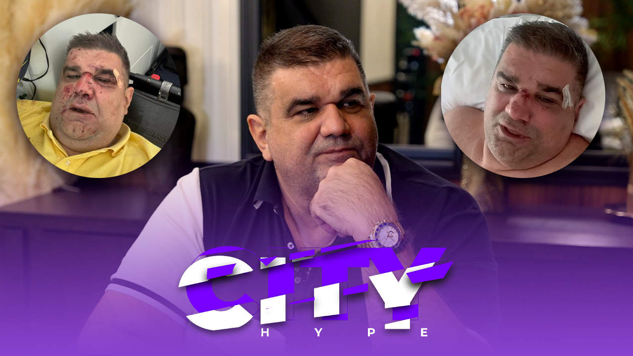 CITY HYPE! Stravičan pokušaj ubistva Saše Mirkovića šokirao je Balkan! (VIDEO)