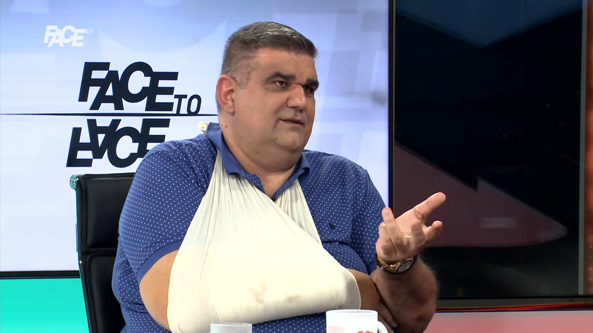 ZBOG ČEGA JE BRUTALNI NAPAD NA SAŠU MIRKOVIĆA – POKUŠAJ UBISTVA? Prvi čovek Hype-a opisao ove detalje koji sve objašnjavaju!