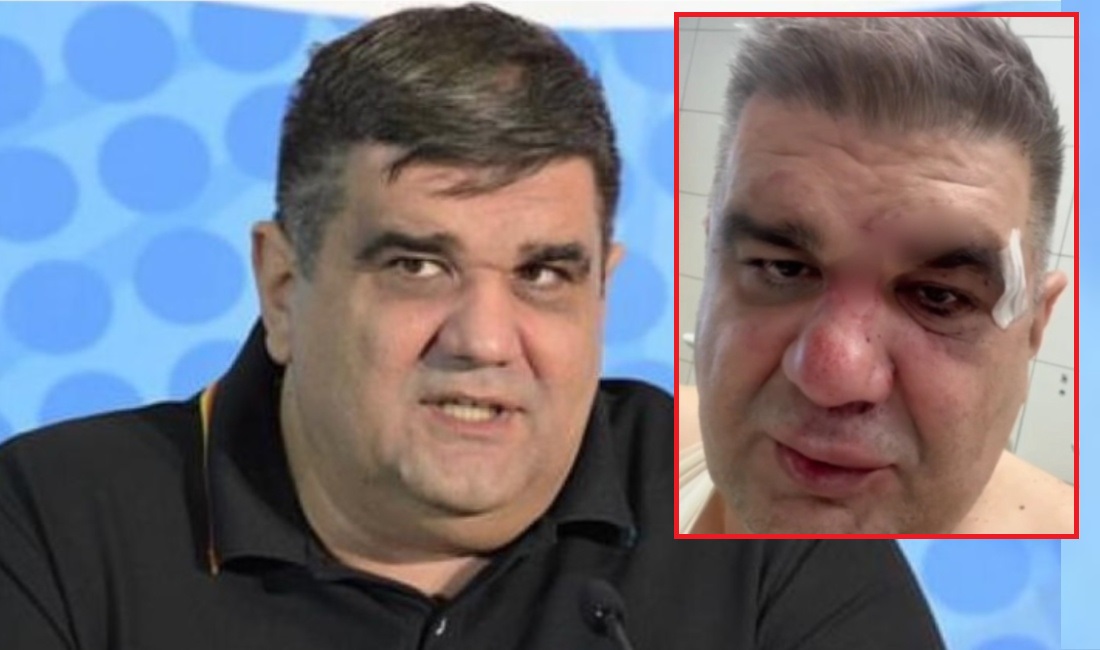 Nakon eksplozije ispred Hype TV, Mirković ponovo meta napada! Od upozorenja na Popa do pokušaja ubistva! (VIDEO)