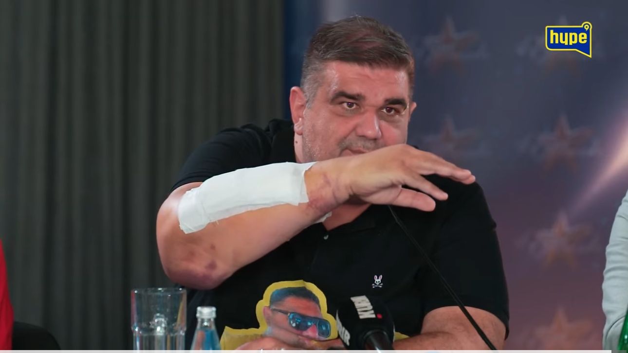 “OVO JE RUKA KOJA IMA 40 ŠAVOVA! Ugrađene su titanijumske pločice!” Saša Mirković ne zna kakve će biti POSLEDICE POVREDA
