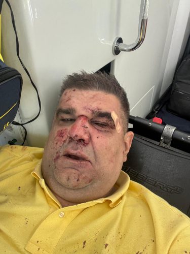 Pokušaj ubistva saše mirkovića Saša Mirković