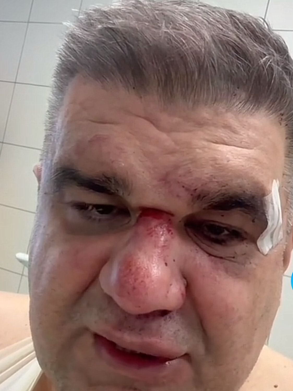 SAŠU MIRKOVIĆA SPREMAJU ZA OPERACIONU SALU NAKON BRUTALNOG NAPADA I POKUŠAJA UBISTVA