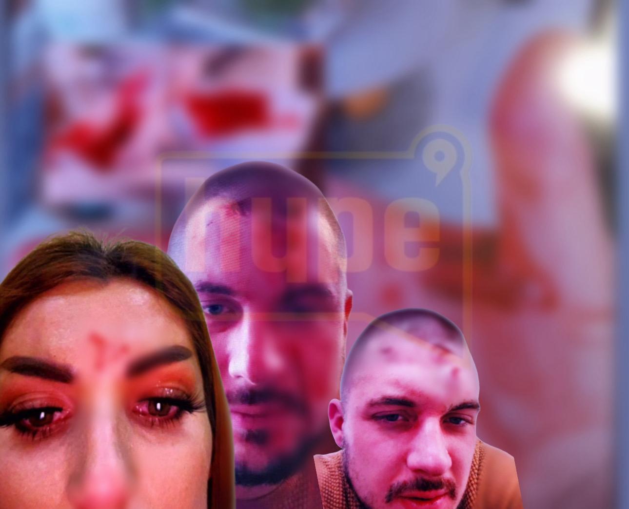 UZNEMIRUJUĆE! Mimas i Gruja se TUKLI – ona ga prijavila za nasilje? Umešao se i njen otac, haos epskih razmera! (FOTO)