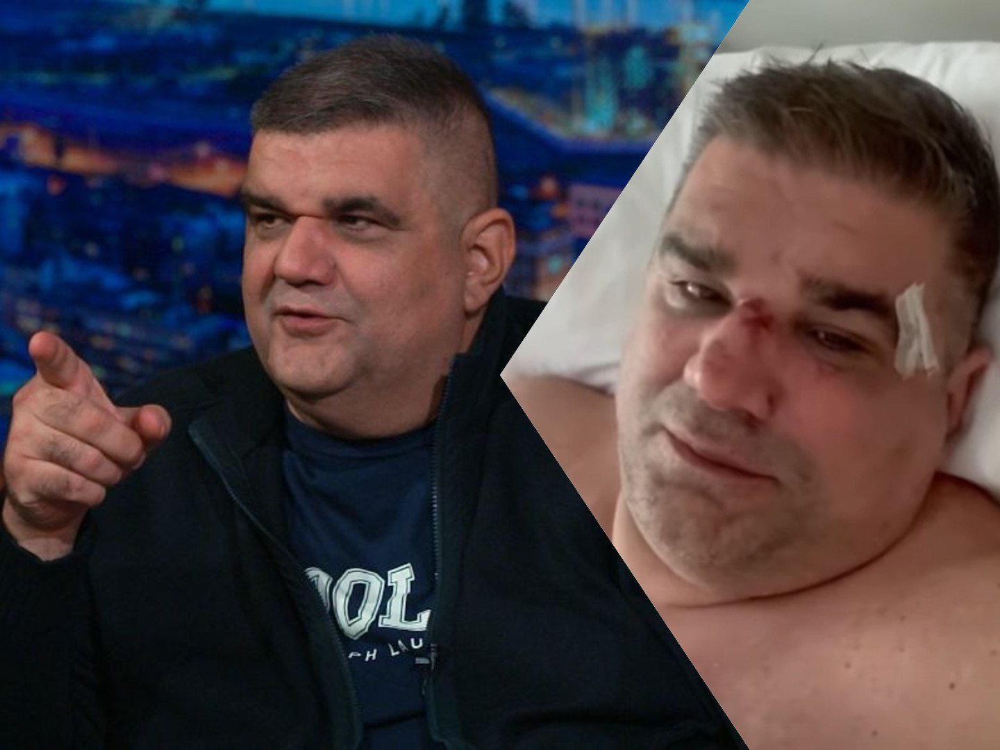 SAŠA MIRKOVIĆ POSLE IZLASKA IZ BOLNICE UPUTIO VELIKU ZAHVALNOST KBC “REBRO”! Ruku su mu OPERISALI VIŠE OD ČETIRI SATA!
