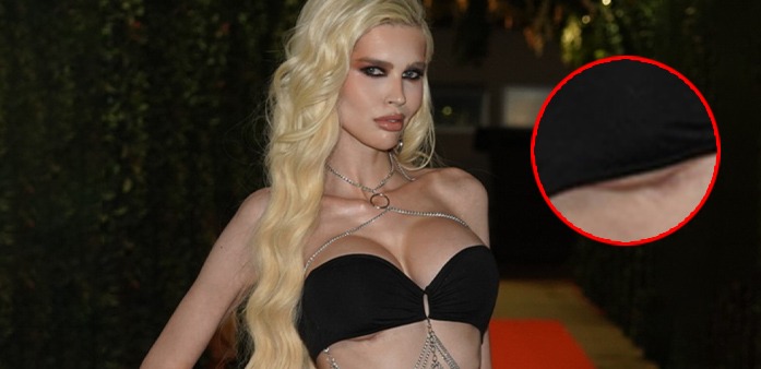 SKANDALOZNO IZDANJE DENIZ DEJM! Umesto s*ksi tela, pokazala ožiljak od operacije! (FOTO)