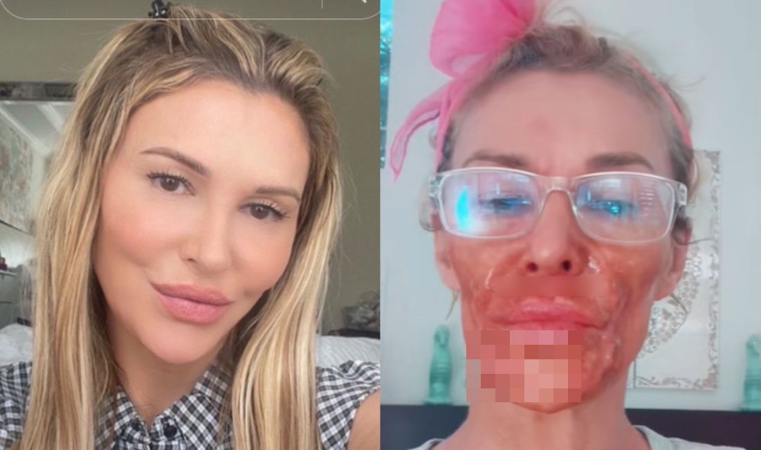 HOROR RIJALITI ZVEZDE: Parazit joj jede lice, pokušala da ga spali kremom za depilaciju! (FOTO)