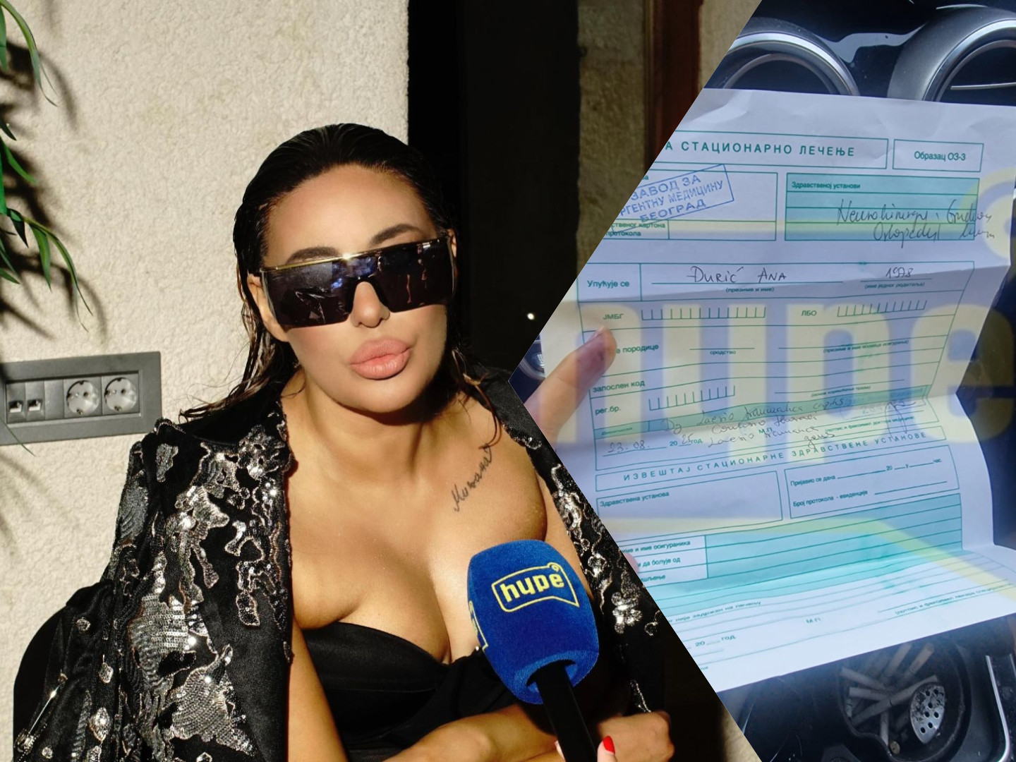 PRETUČENA ANA NIKOLIĆ! Njen partner Rale bio nasilan – HYPE TV SAZNAJE!