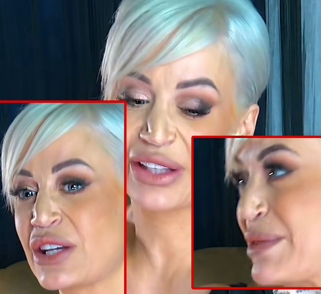 DUŠICA JAKOVLJEVIĆ IZMASAKRIRALA LICE: Gledaoci ZGROŽENI prizorom, još jedna NEUSPELA OPERACIJA?