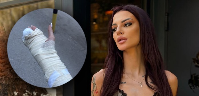 TARA SIMOV ZAVRŠILA U GIPSU! Po izlasku iz bolnice, obelodanila sve detalje povrede! (FOTO)